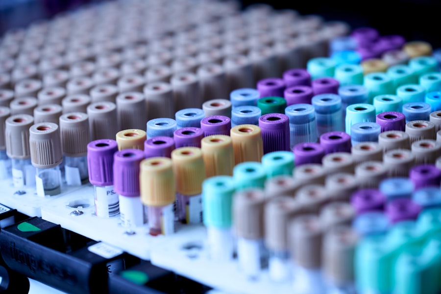 Racked clinical specimen tubes in an analyser tray, photographed close